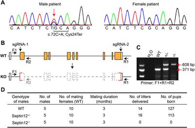 Homozygous Loss of Septin12, but not its Haploinsufficiency, Leads to Male Infertility and Fertilization Failure